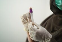 África declara emergência sanitária devido ao vírus mpox