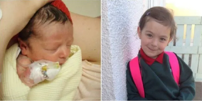 As primeiras suspeitas da mãe em relação à saúde do bebê começaram na gravidez. Vignes, de 31 anos, se dirigiu à clínica na trigésima quarta semana de gestação, pois não sentia o bebê se mexer em nenhum momento. Foto: El Herlado