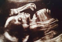 cd8d1d90-349f-11e5-a6d6-6109c2db383c_PAY-Pregnant-woman-had-ultrasound-scan-and-