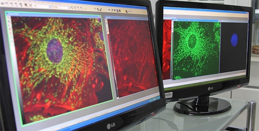 Vírus geneticamente modificado combate câncer de próstata