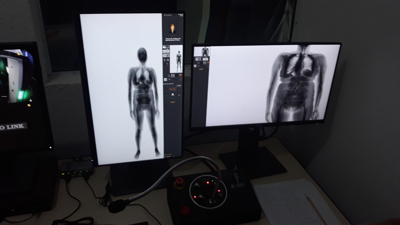 Presídio de Alcaçuz passa a operar o “body scan” em dia de visitas