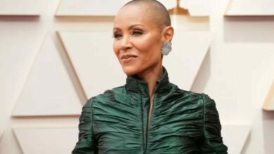 Alopecia areata, doença que acomete Jada Smith, tem tratamento