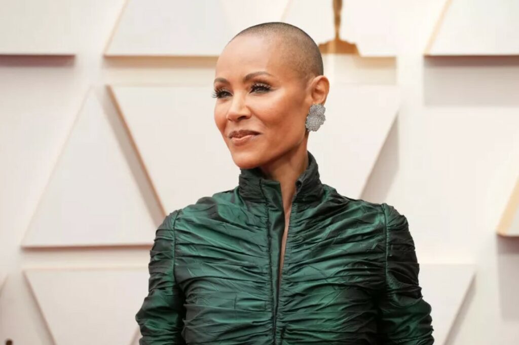 Alopecia areata, doença que acomete Jada Smith, tem tratamento