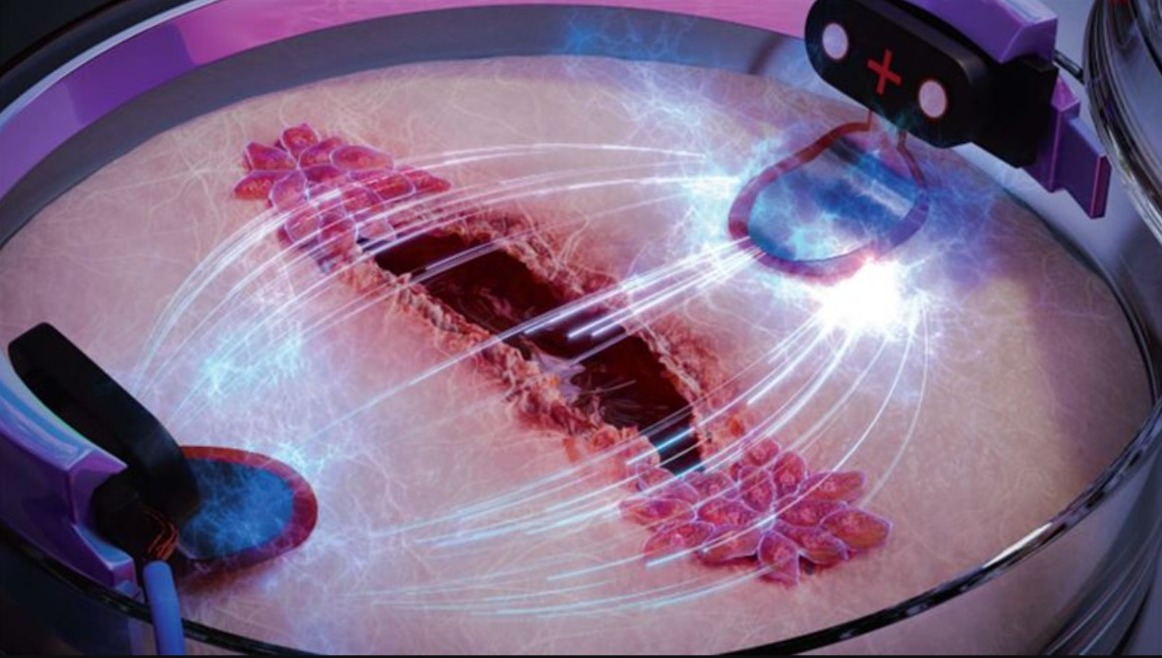 Cicatrizacao por eletrcidade