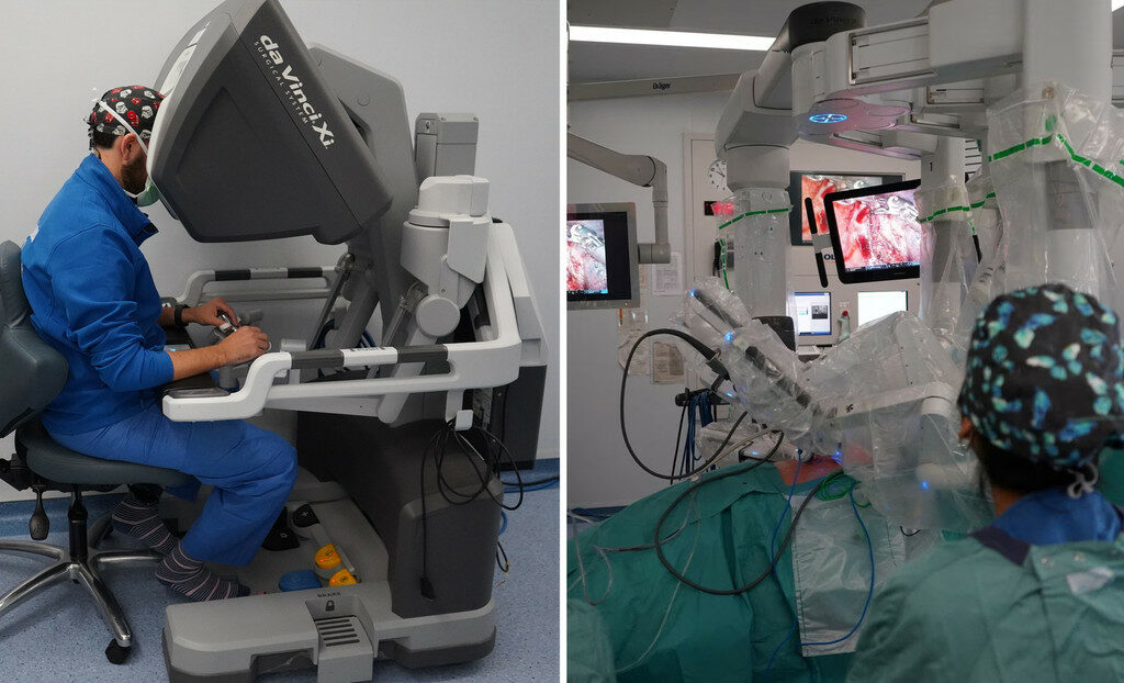 Primeiro transplante de pulmão totalmente robótico do mundo