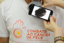 Mutirão atende população hoje, no dia de combate ao câncer de pele